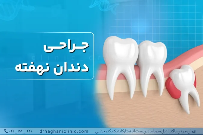 جراحی دندان نهان در کلینیک دکتر حقانی