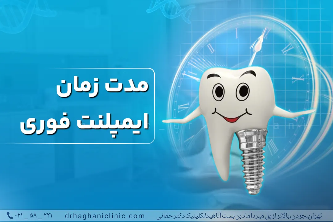 مدت زمان ایمپلنت فوری دندان