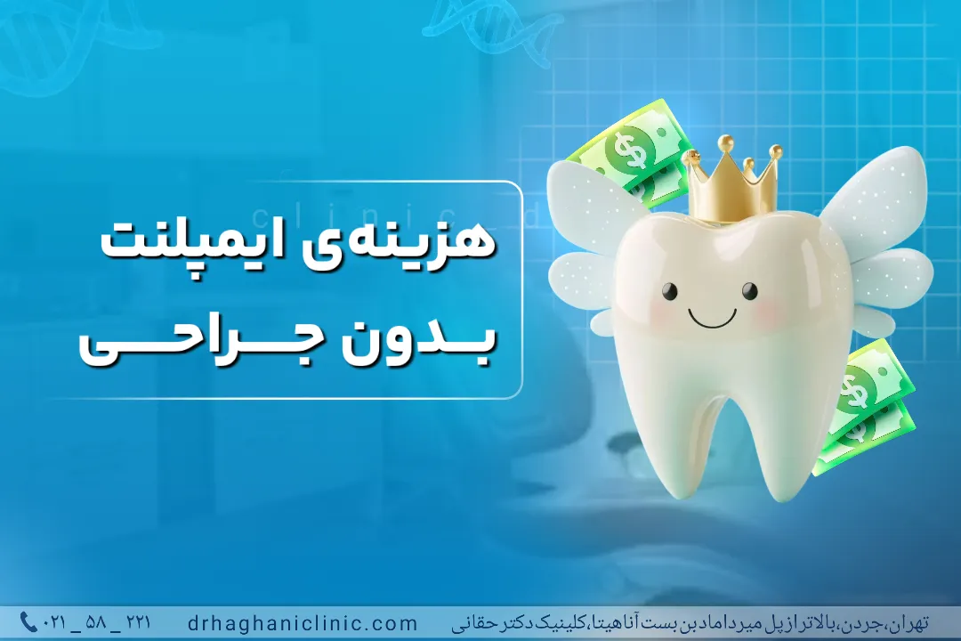 هزینه ایمپلنت بدون انجام جراحی