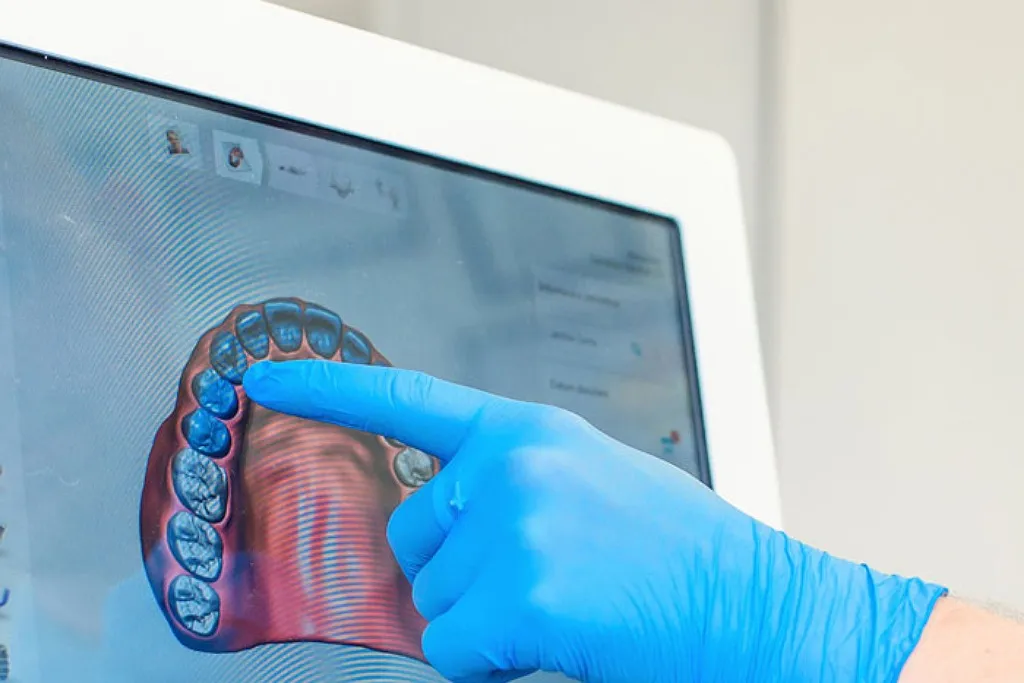 کامپوزیت دیجیتال چیست 