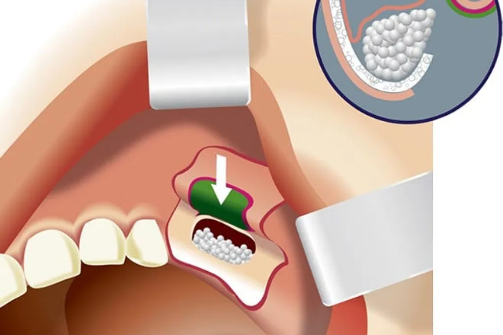 چرا کلینیک دندانپزشکی دکتر حقانی برای سینوس لیفت انتخاب مناسبی است؟