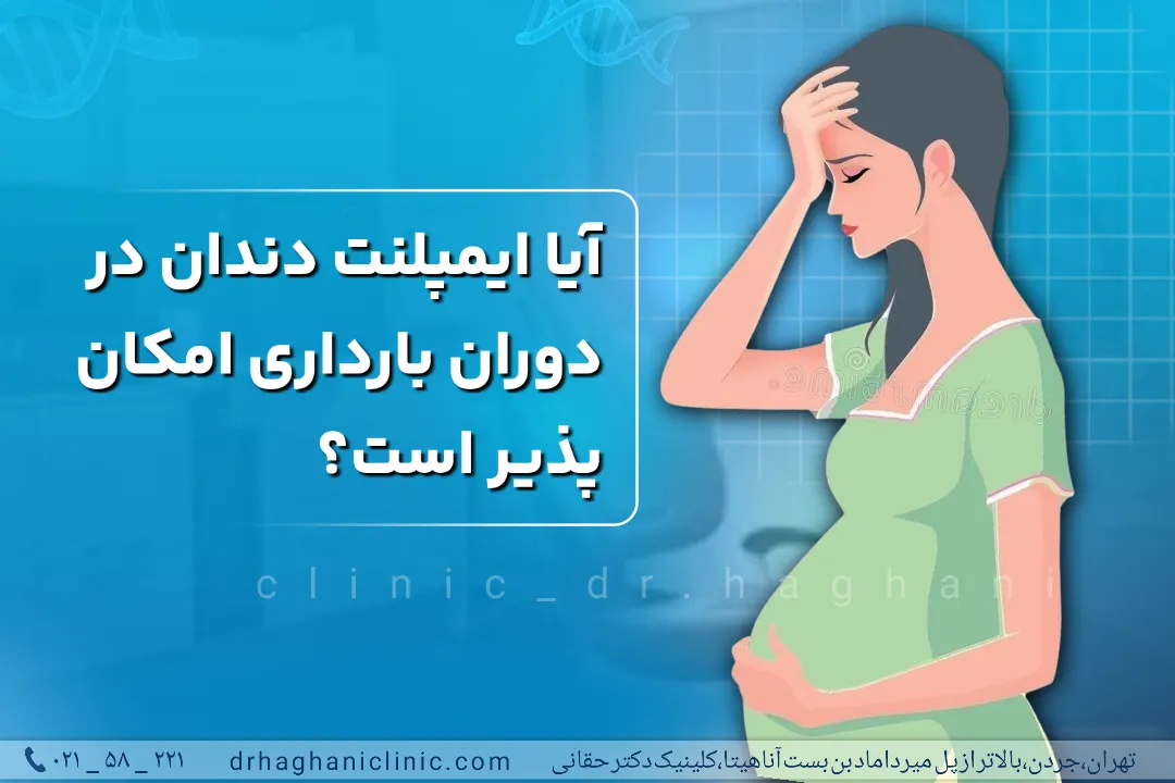 ایمپلنت در بارداری