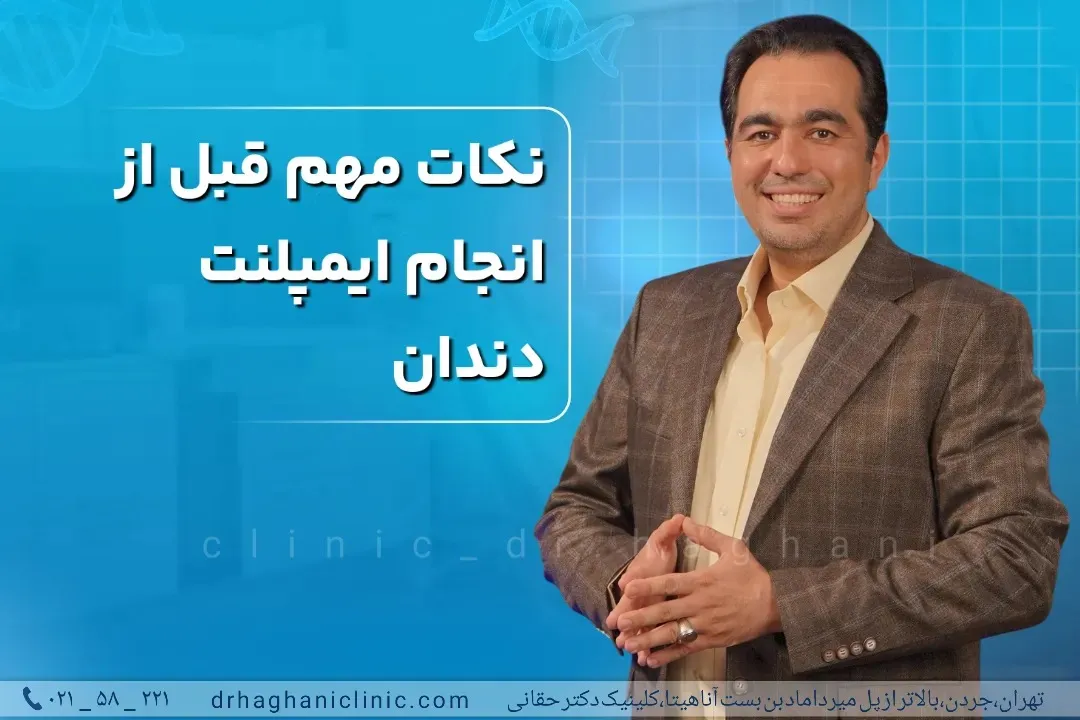 بررسی نکات مهم قبل ایمپلنت