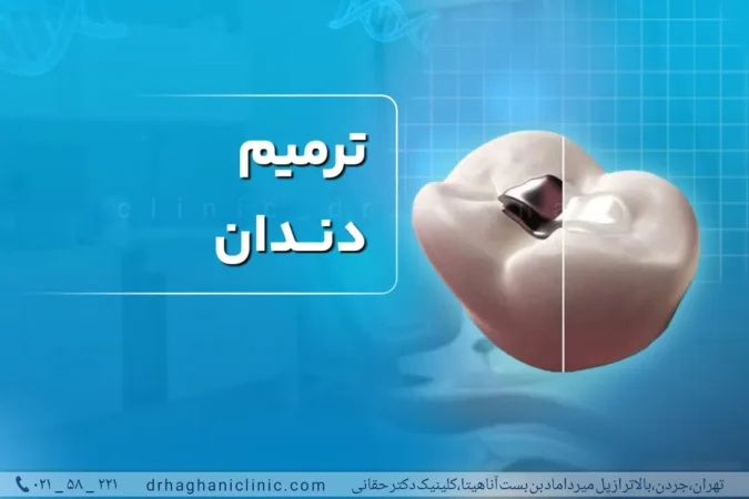 ترمیم دندان در بهترین کلینیک دندانپزشکی در جردن تهران