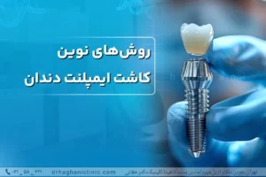 روش های نوین کاشت ایمپلنت دندان