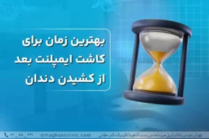 بهترین زمان کاشت ایمپلنت بعد کشیدن دندان