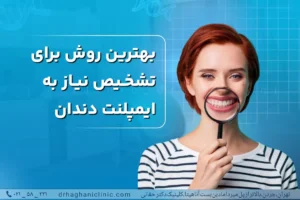 بهترین روش تشخیص نیاز به ایمپلنت