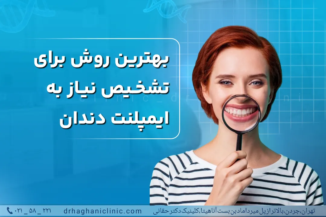 بهترین روش تشخیص نیاز به ایمپلنت