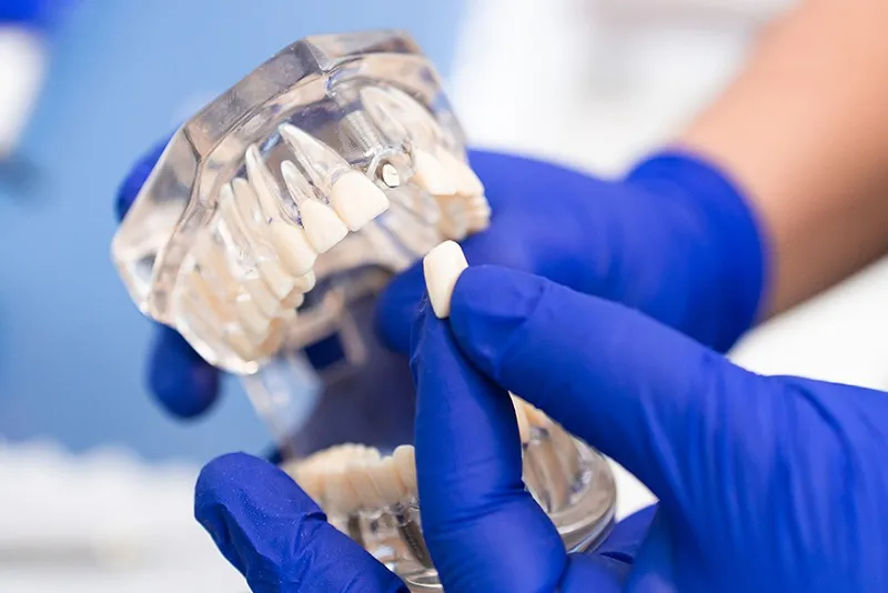 بررسی مشکلات زیبایی و تأثیر بر لبخند