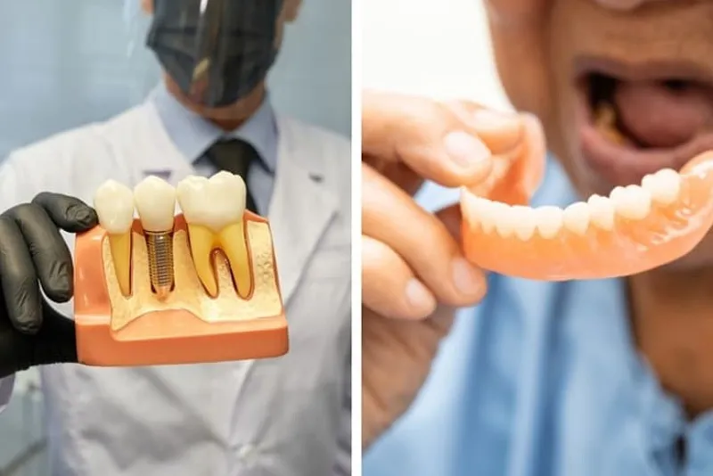 محدودیت های ایمپلنت و دندان مصنوعی