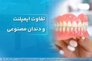 تفاوت ایمپلنت و دندان مصنوعی