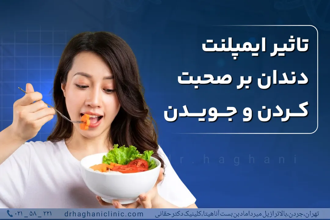 تاثیر ایمپلنت دندان بر صحبت کردن و جویدن