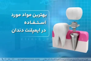 بهترین مواد ایمپلنت