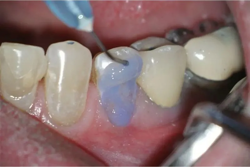 فلسفه و تکنولوژی پشت محصولات Bisco