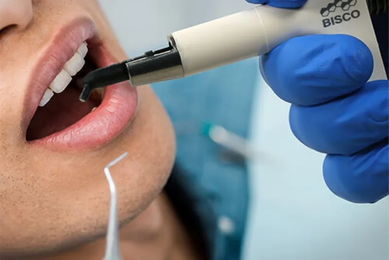 مزایای کلی کامپوزیت‌های Bisco