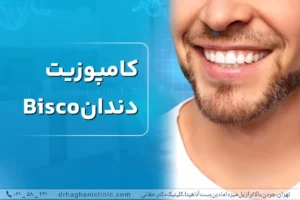 کامپوزیت دندان bisco