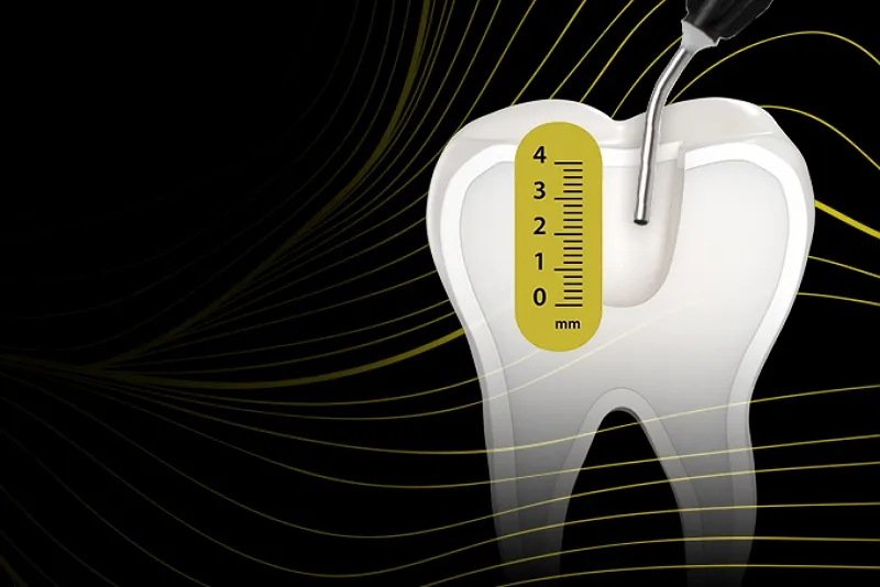 مقایسه Coltene با برندهای دیگر