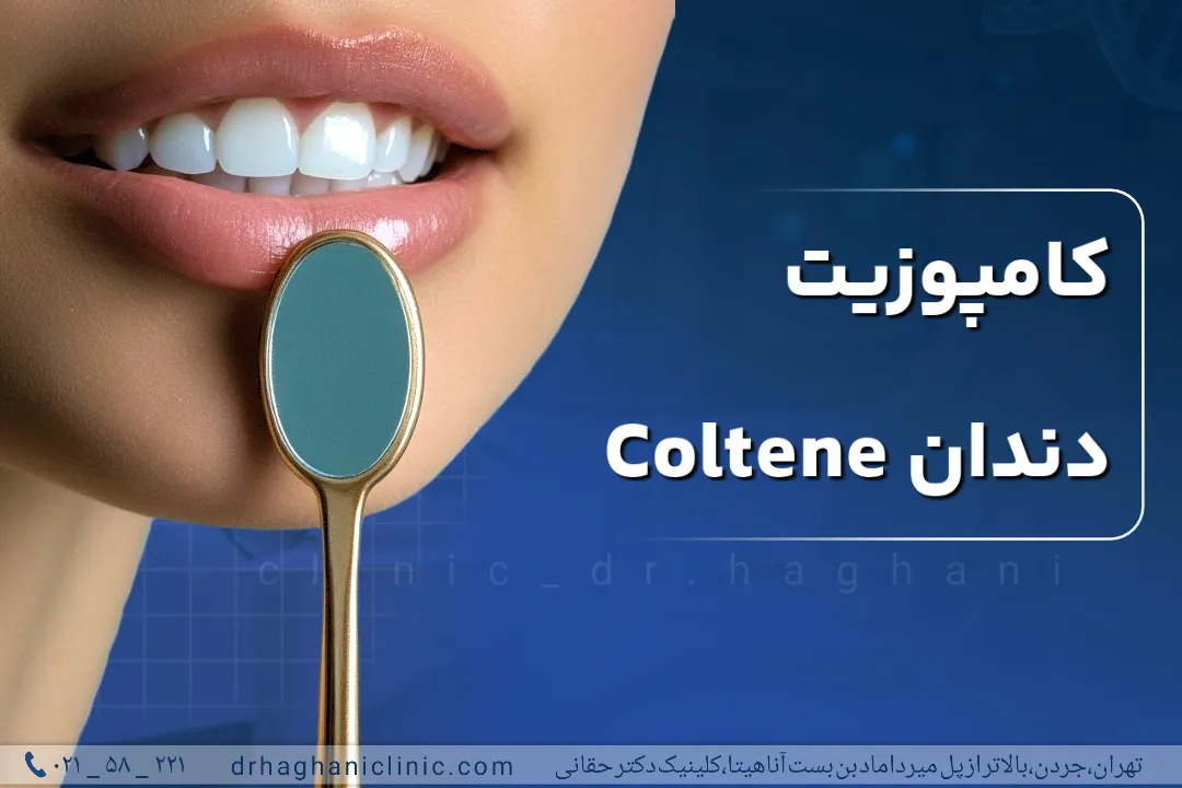 کامپوزیت دندان coltene