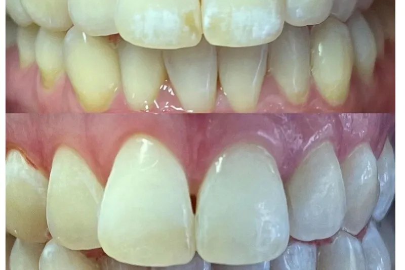 Ecosite Elements؛ ترکیب زیبایی و استحکام