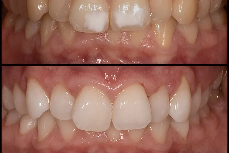 محصولات مکمل DMG در حوزه کامپوزیت