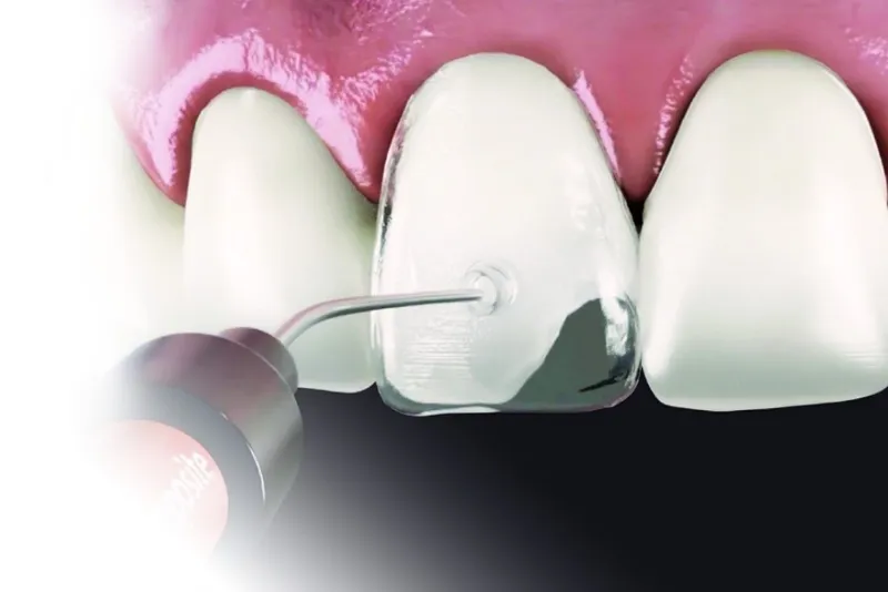 فناوری نانوهیبریدی در کامپوزیت‌های DMP