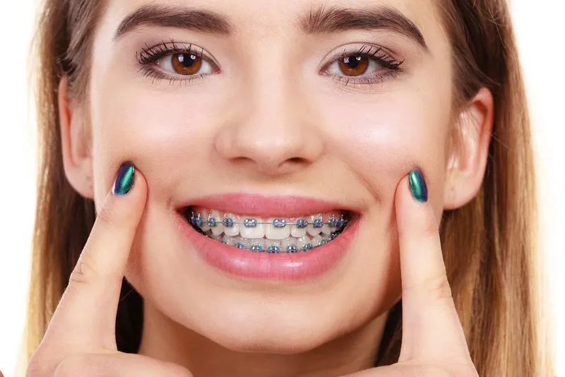 عوامل مؤثر بر مدت زمان درمان ارتودنسی