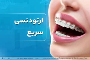 ارتودنسی سریع