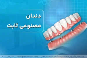 دندان مصنوعی ثابت
