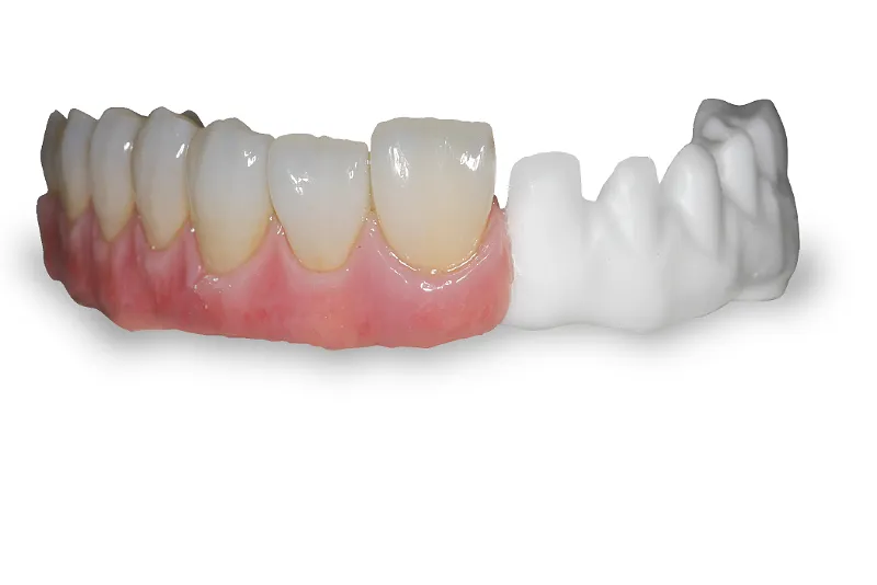 تعریف و ترکیب مواد کامپوزیت هیبرید