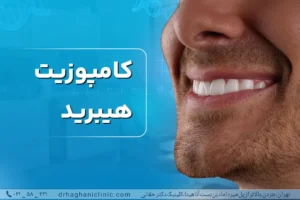 کامپوزیت هیبرید