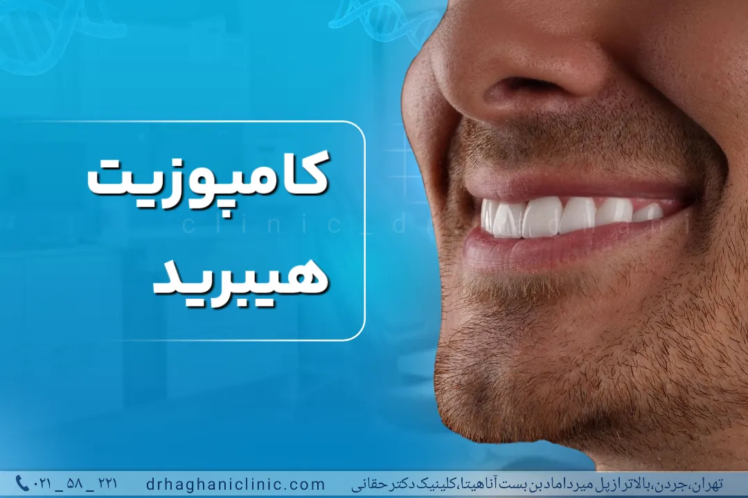 کامپوزیت هیبرید