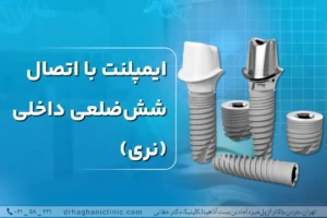 ایمپلنت با اتصال شش ضلعی داخلی (نری)