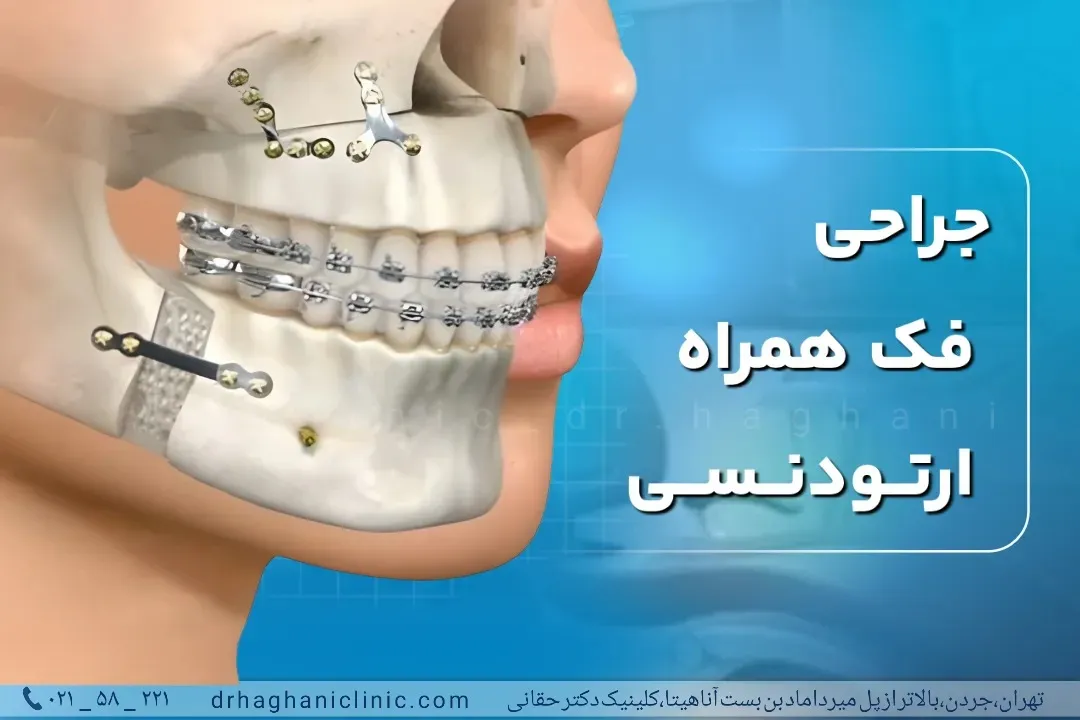 جراحی فک همراه ارتودنسی