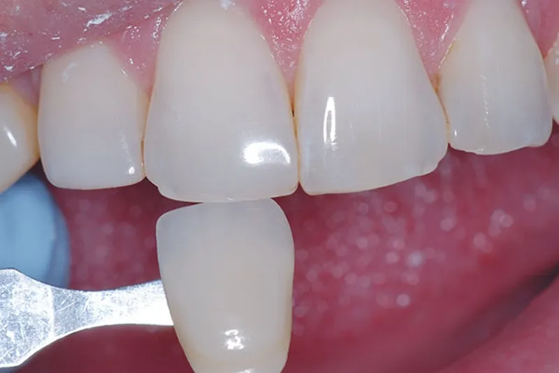 کاربردهای کامپوزیت ماکروفیل