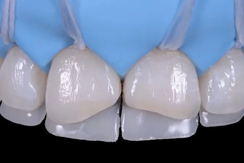 کامپوزیت ماکروفیل چیست