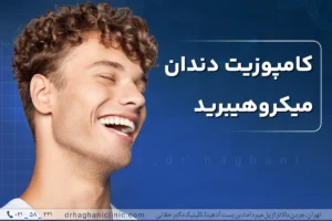 کامپوزیت دندان میکرو هیبرید