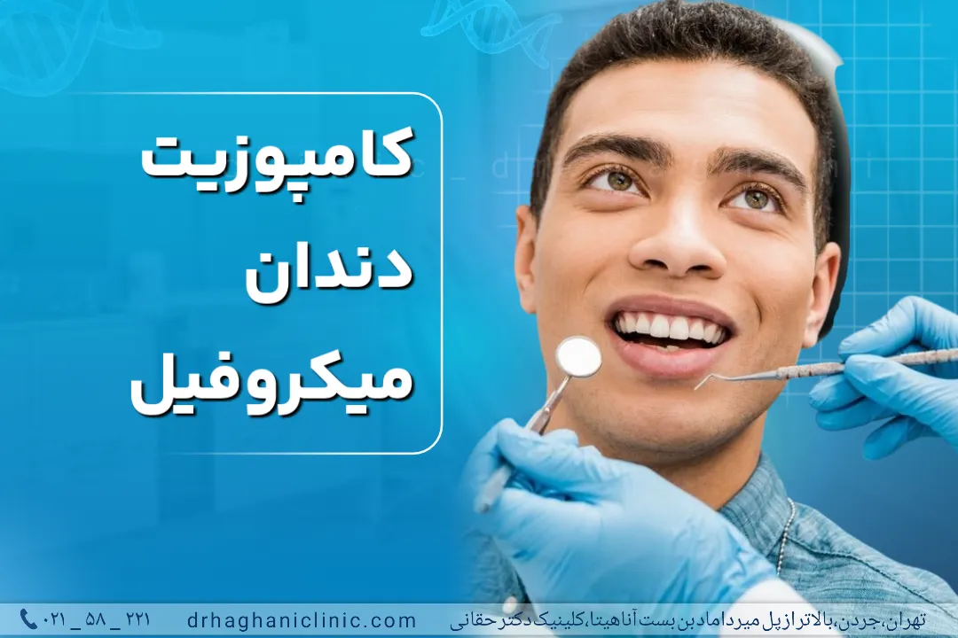 کامپوزیت دندان میکروفیل