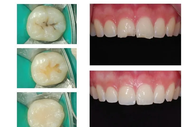 کامپوزیت نانو هیبرید چیست