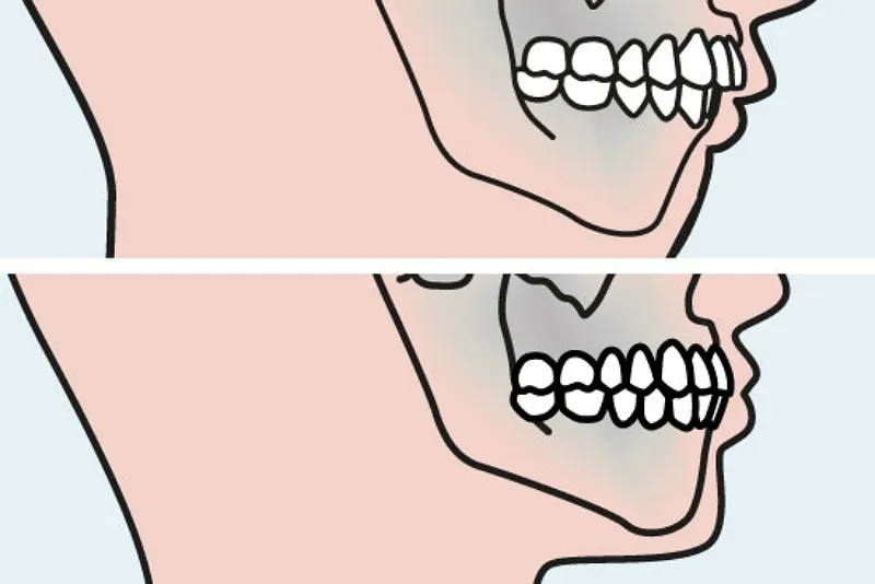 معرفی ارتوسرجری 