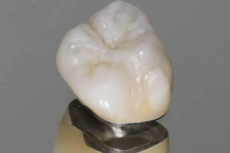 انواع روکش پی اف ام