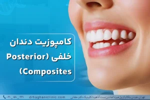 کامپوزیت دندان خلفی