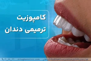 کامپوزیت ترمیمی دندان
