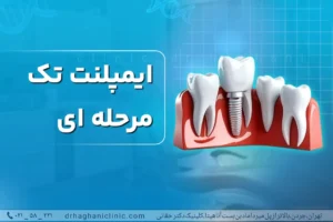ایمپلنت تک مرحله ای