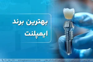 بهترین برند ایمپلنت دندان