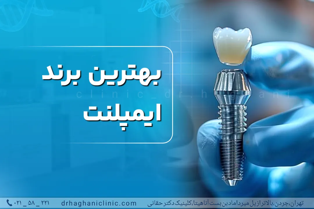 بهترین برند ایمپلنت دندان