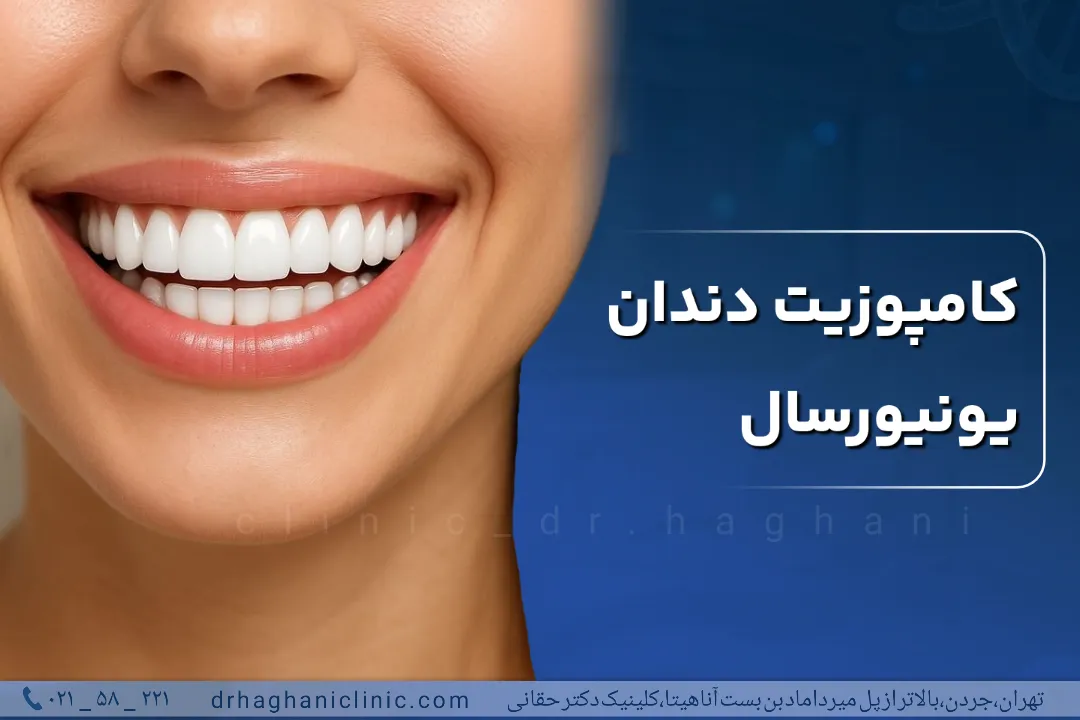 کامپوزیت یونیورسال