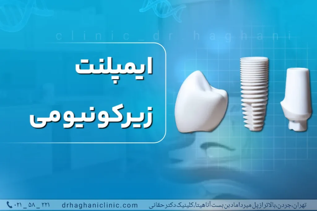 ایمپلنت زیرکونیومی