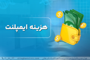هزینه ایمپلنت دندان