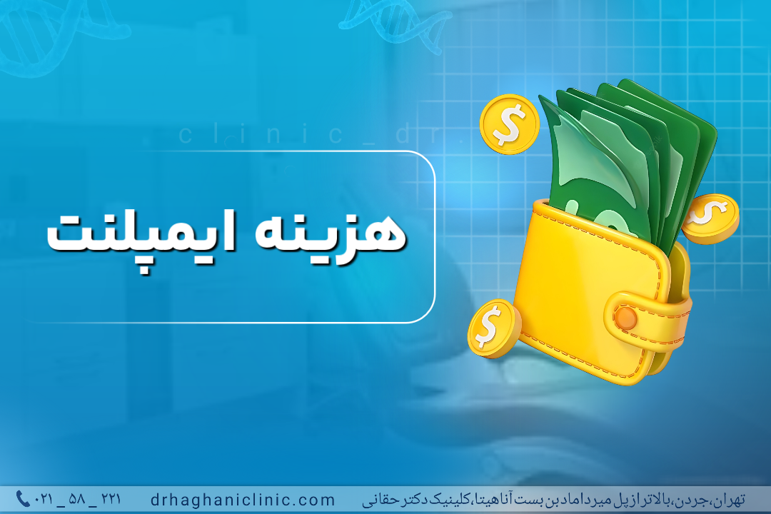هزینه ایمپلنت دندان