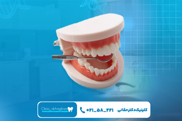 دندانپزشکی اقساطی